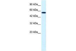 CHEK1 antibody used at 0. (CHEK1 antibody)