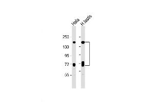 Western Blot at 1:1000 dilution Lane 1: Hela whole cell lysate Lane 2: human testis lysate Lysates/proteins at 20 ug per lane. (NASP antibody  (N-Term))