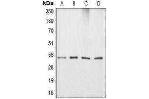 Western blot analysis of Apolipoprotein E expression in HeLa (A), HepG2 (B), NIH3T3 (C), PC12 (D) whole cell lysates. (APOE antibody  (Center))