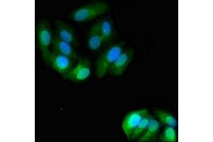 Immunofluorescent analysis of HepG2 cells using ABIN7144713 at dilution of 1:100 and Alexa Fluor 488-congugated AffiniPure Goat Anti-Rabbit IgG(H+L) (Asialoglycoprotein Receptor 2 antibody  (AA 63-286))