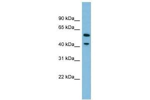 DUS1L antibody used at 1 ug/ml to detect target protein. (DUS1L antibody)