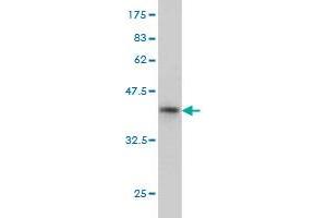 Western Blot detection against Immunogen (36. (NAT2 antibody  (AA 96-195))