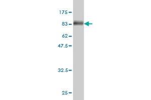 Western Blotting (WB) image for anti-Malic Enzyme 1, NADP(+)-Dependent, Cytosolic (ME1) (AA 1-572) antibody (ABIN561774)