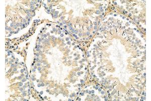 ABIN6263069 and ABIN6278932 at 1/100 staining Rat testis tissue by IHC-P. (MAGEC3 antibody)