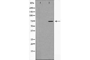 Western blot analysis of hnRNP M expression in HT29 cells,The lane on the left is treated with the antigen-specific peptide. (HNRNPM antibody  (N-Term))