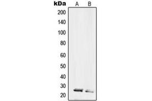 Western blot analysis of RPL10L expression in HL60 (A), HeLa (B) whole cell lysates. (RPL10L antibody  (C-Term))