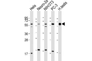 All lanes : Anti-TXNRD1 Antibody (C-Term) at 1:2000 dilution Lane 1: Hela whole cell lysate Lane 2: Neuro-2a whole cell lysate Lane 3: NIH/3T3 whole cell lysate Lane 4: PC-3 whole cell lysate Lane 5: human testis lysate Lysates/proteins at 20 μg per lane. (TXNRD1 antibody  (AA 516-550))