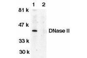 Western blot analysis of DNase II in human spleen tissue lysate in the absence (lane 1) or presence (lane 2) of blocking peptide with DNase II antibody at 1μg/ml. (DNASE2 antibody)