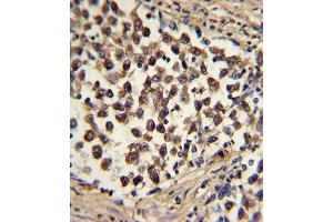 Immunohistochemistry (IHC) image for anti-SNAI antibody (ABIN2912021) (SNAI antibody)