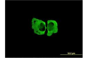 Immunofluorescence of monoclonal antibody to MSRA on HeLa cell.