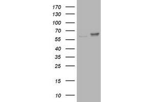 Image no. 1 for anti-Ribophorin II (RPN2) antibody (ABIN1500757) (Ribophorin II antibody)
