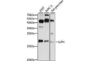 Western blot analysis of extracts of various cell lines, using LLPH antibody (ABIN7268289) at 1:1000 dilution. (LLPH antibody  (AA 1-129))