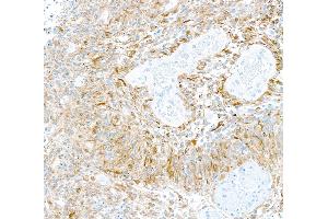Immunohistochemistry (IHC) image for anti-Tubulin, beta 3 (TUBB3) (AA 400-450) antibody (ABIN7453957) (Recombinant TUBB3 antibody  (AA 400-450))