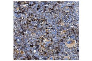 IHC analysis of CD82 using anti-CD82 antibody (ABIN7601301).
