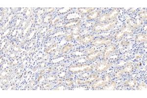 Detection of IL18 in Rabbit Kidney Tissue using Polyclonal Antibody to Interleukin 18 (IL18) (IL-18 antibody  (AA 32-192))