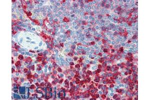Immunohistochemistry (IHC) image for anti-Integrin beta 2 (ITGB2) antibody (ABIN94005)