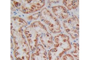 Immunohistochemistry (IHC) image for anti-Carnitine Palmitoyltransferase 2 (CPT2) (AA 152-658) antibody (ABIN1867358)