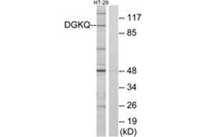 Western blot analysis of extracts from HT-29 cells, using DGKQ Antibody. (DGKQ antibody  (AA 691-740))