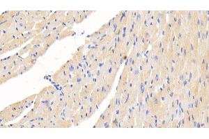 Immunohistochemistry (IHC) image for anti-Microtubule-Associated Protein 1B (MAP1B) (AA 2203-2464) antibody (ABIN7444907)