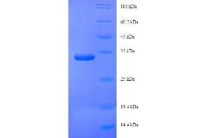 SDS-PAGE (SDS) image for Adhesion Regulating Molecule 1 (Adrm1) (AA 2-156) protein (His-SUMO Tag) (ABIN5711183) (ADRM1 Protein (AA 2-156) (His-SUMO Tag))
