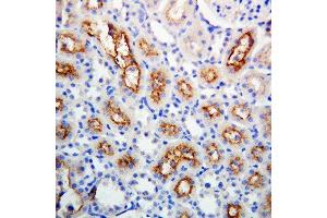 Anti-Connexin 32/GJB1 antibody, IHC(P) IHC(P):Rat Kidney Tissue (GJB1 antibody  (Middle Region))