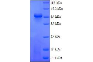 SDS-PAGE (SDS) image for Fibrinogen-Like 2 (FGL2) (AA 24-439) protein (His tag) (ABIN4976097)