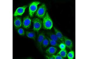 CRC cells were fixed in paraformaldehyde, permeabilized with 0. (KRT20 antibody)