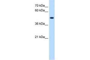 Western Blotting (WB) image for anti-serine/threonine/tyrosine Kinase 1 (STYK1) antibody (ABIN2463064) (STYK1 antibody)