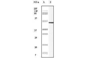Western blot analysis using Vimentin mouse mAb against truncated Vimentin recombinant protein. (Vimentin antibody)