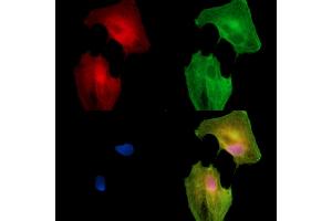 ABIN7096400 and ABIN7100464 staining  cells by IF/ICC.