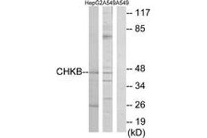 Western blot analysis of extracts from HepG2/A549 cells, using CHKB Antibody. (CHKB antibody  (AA 301-350))