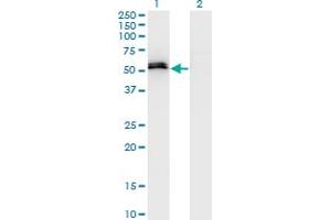 Western Blot analysis of SPP1 expression in transfected 293T cell line by SPP1 monoclonal antibody (M15), clone 3C7. (Osteopontin antibody  (AA 21-129))