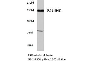 Western blot (WB) analyzes of IRS-1 antibody in extracts from A549 cells. (IRS1 antibody)