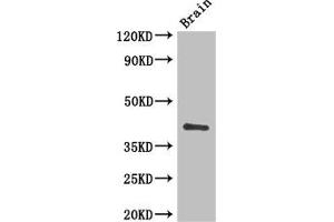Western Blot Positive WB detected in: Mouse brain tissue All lanes: CD34 antibody at 3 μg/mL Secondary Goat polyclonal to rabbit IgG at 1/50000 dilution Predicted band size: 41, 36 kDa Observed band size: 41 kDa (CD34 antibody  (AA 124-375))