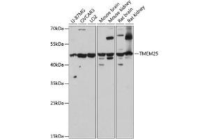 Western blot analysis of extracts of various cell lines, using TMEM25 antibody (ABIN7270963) at 1:3000 dilution. (TMEM25 antibody  (AA 223-322))