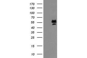 Image no. 1 for anti-Protein Arginine Methyltransferase 2 (PRMT2) antibody (ABIN1500418) (PRMT2 antibody)