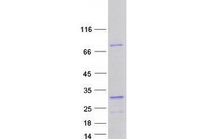 Validation with Western Blot (RAVER1 Protein (Myc-DYKDDDDK Tag))