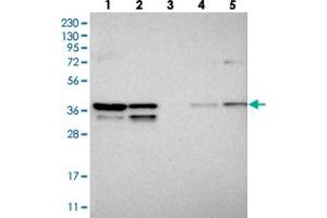 Western blot analysis of Lane 1: RT-4, Lane 2: U-251 MG, Lane 3: Human Plasma, Lane 4: Liver, Lane 5: Tonsil with SNRNP40 polyclonal antibody  at 1:250-1:500 dilution. (SNRNP40 antibody)