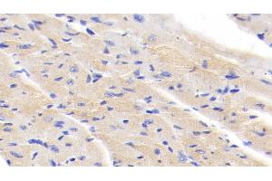Detection of IkBb in Mouse Cardiac Muscle Tissue using Polyclonal Antibody to Inhibitory Subunit Of NF Kappa B Beta (IkBb) (Inhibitory Subunit of NF kappa B beta (AA 117-345) antibody)