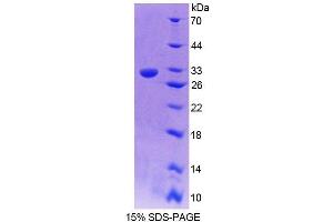 SDS-PAGE (SDS) image for Complement Component C9 (C9) (AA 22-265) protein (His tag) (ABIN2124470)