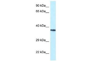 Western Blot showing PSTPIP2 antibody used at a concentration of 1 ug/ml against Jurkat Cell Lysate (PSTPIP2 antibody  (Middle Region))