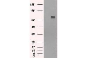 HEK293T cells were transfected with the pCMV6-ENTRY control (Left lane) or pCMV6-ENTRY BTK (Right lane) cDNA for 48 hrs and lysed. (BTK antibody)