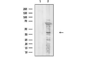 anti-Chemokine (C-C Motif) Receptor-Like 2 (CCRL2) (Internal Region) antibody
