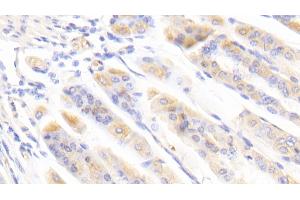 Detection of BFP in Mouse Stomach Tissue using Polyclonal Antibody to Brain Finger Protein (BFP) (RNF112 antibody  (AA 403-647))