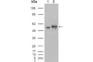 Western blot analysis using Calreticulin mouse mAb against HEK293T cells transfected with the pCMV6-ENTRY control (1) and pCMV6-ENTRY Calreticulin cDNA (2). (Calreticulin antibody)