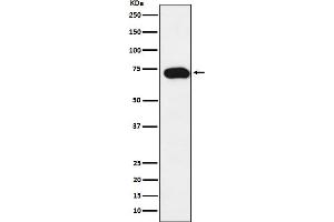Western blot analysis of SLC22A1 expression in SW480 cell lysate.