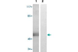 Western blot analysis of Lane 1: PMA treated HepG2 cells, Lane 2: antigen-specific peptide treated HepG2 cells with WWOX (phospho Y33) polyclonal antibody  at 1:500-1000 dilution. (WWOX antibody  (pTyr33))