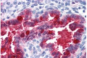Human Uterus (formalin-fixed, paraffin-embedded) stained with NQO1 antibody ABIN364280 at 1:100 followed by biotinylated anti-mouse IgG secondary antibody ABIN481714, alkaline phosphatase-streptavidin and chromogen. (NQO1 antibody)
