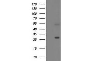 Western Blotting (WB) image for anti-Sepiapterin Reductase (SPR) antibody (ABIN1501112)