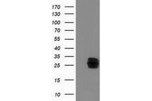 HEK293T cells were transfected with the pCMV6-ENTRY control (Left lane) or pCMV6-ENTRY CLPP (Right lane) cDNA for 48 hrs and lysed. (CLPP antibody)